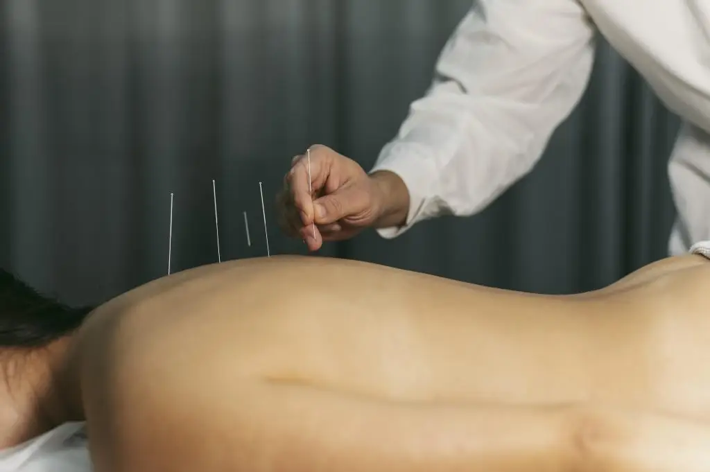Acupuncturist in Best